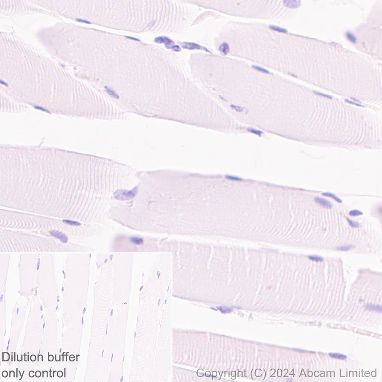 Immunohistochemistry (Formalin/PFA-fixed paraffin-embedded sections) - HRP Anti-RPE65 antibody [EPR22579-44] (AB324030)