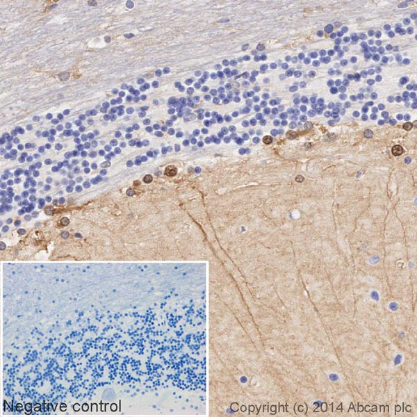 Immunohistochemistry (Formalin/PFA-fixed paraffin-embedded sections) - HRP Anti-S100 beta antibody [EP1576Y] - Astrocyte Marker (AB195535)