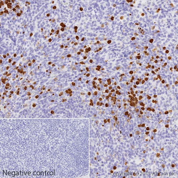 Immunohistochemistry (Formalin/PFA-fixed paraffin-embedded sections) - HRP Anti-S100A8 antibody [EPR3554] (AB201473), expandable thumbnail