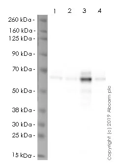 Western blot - HRP Anti-S6K1 antibody [E343] (AB237428)