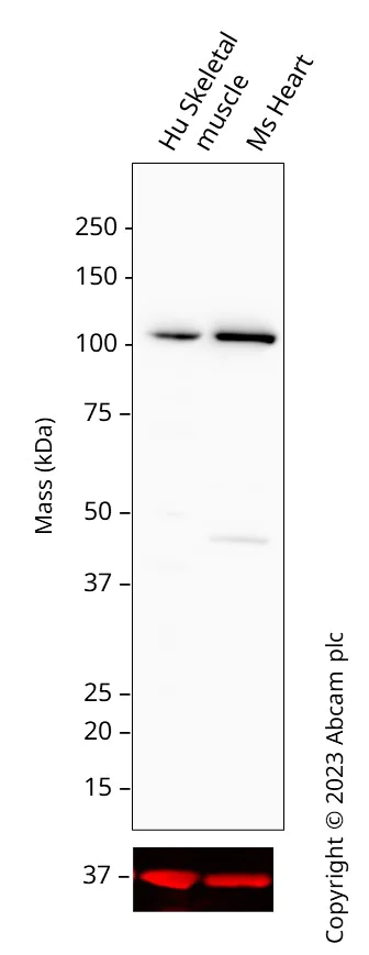 Western blot - HRP Anti-Sarcomeric Alpha Actinin antibody [EP2529Y] (AB314407)