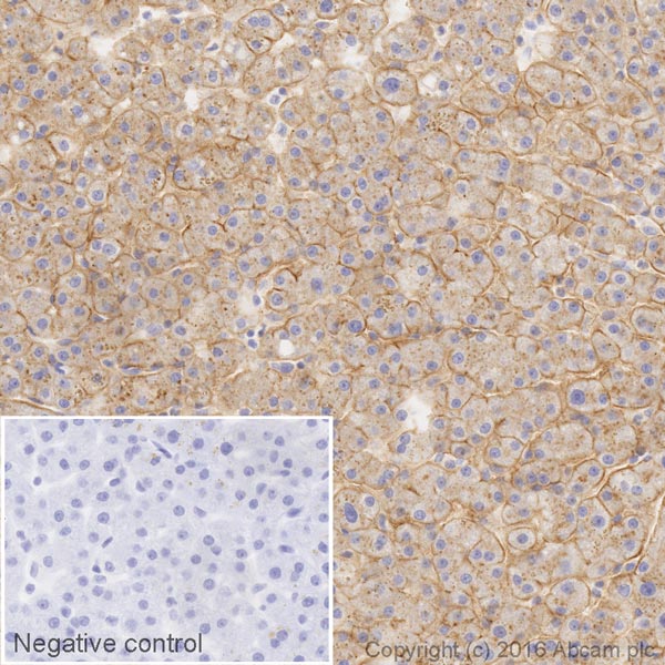 Immunohistochemistry (Formalin/PFA-fixed paraffin-embedded sections) - HRP Anti-Scavenging Receptor SR-BI antibody [EP1556Y] (AB206233), expandable thumbnail