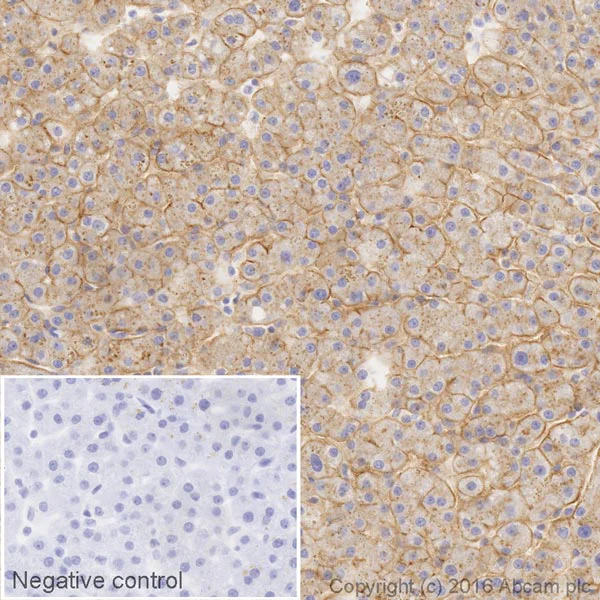 Immunohistochemistry (Formalin/PFA-fixed paraffin-embedded sections) - HRP Anti-Scavenging Receptor SR-BI antibody [EP1556Y] (AB206233)