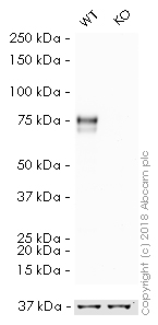 Western blot - HRP Anti-Scavenging Receptor SR-BI antibody [EP1556Y] (AB206233), expandable thumbnail