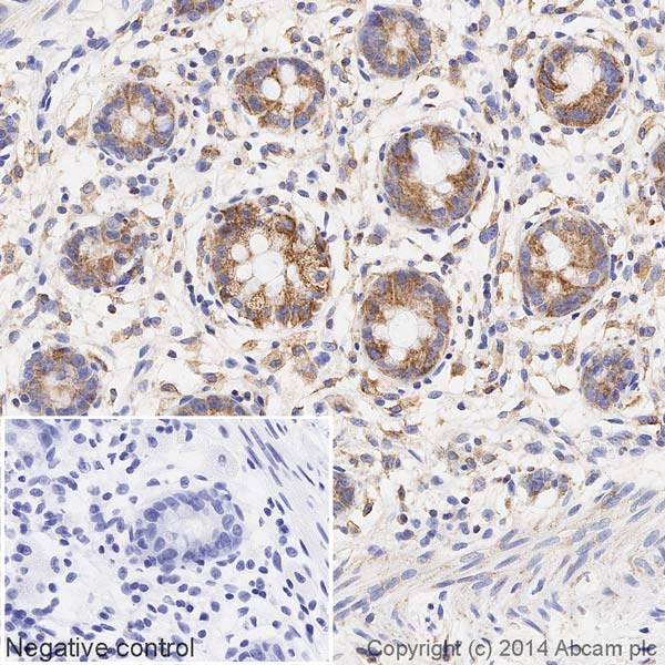 Immunohistochemistry (Formalin/PFA-fixed paraffin-embedded sections) - HRP Anti-SDHA antibody [2E3GC12FB2AE2] (AB198493), expandable thumbnail