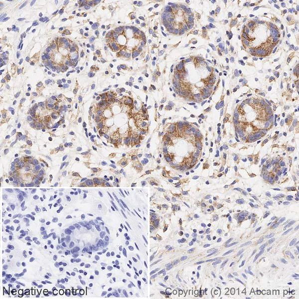 Immunohistochemistry (Formalin/PFA-fixed paraffin-embedded sections) - HRP Anti-SDHA antibody [2E3GC12FB2AE2] (AB198493)