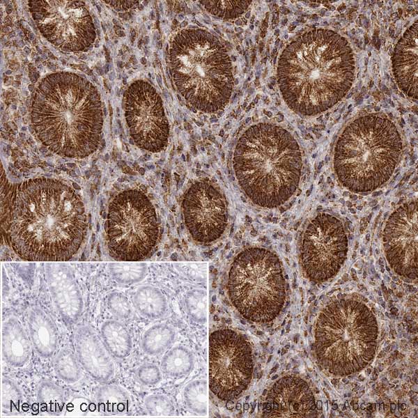Immunohistochemistry (Formalin/PFA-fixed paraffin-embedded sections) - HRP Anti-SDHB antibody [21A11AE7] (AB197903), expandable thumbnail