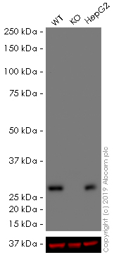 Western blot - HRP Anti-SDHB antibody [21A11AE7] (AB197903), expandable thumbnail