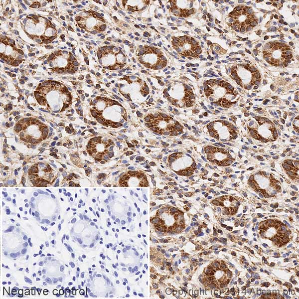 Immunohistochemistry (Formalin/PFA-fixed paraffin-embedded sections) - HRP Anti-SDHB antibody [EPR10880] (AB198329), expandable thumbnail