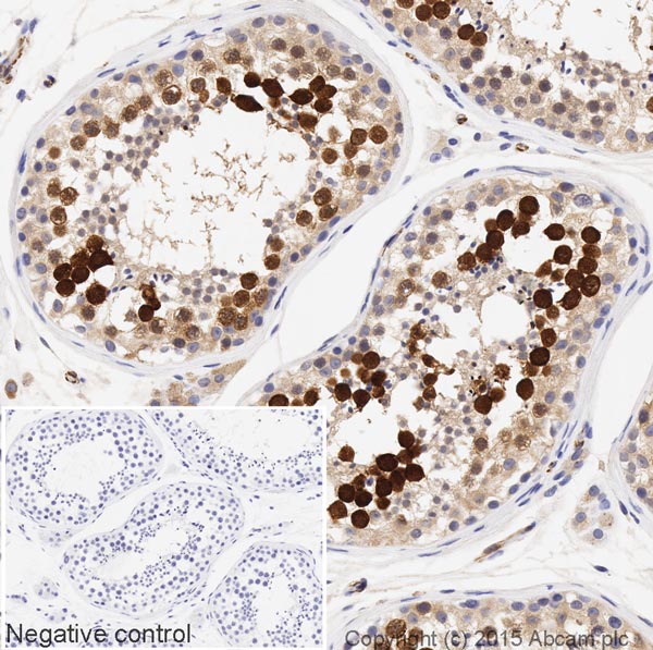 Immunohistochemistry (Formalin/PFA-fixed paraffin-embedded sections) - HRP Anti-Securin antibody [EPR3240] (AB199239), expandable thumbnail
