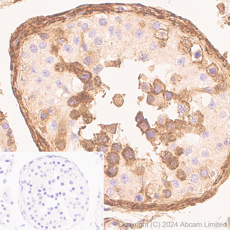 Immunohistochemistry (Formalin/PFA-fixed paraffin-embedded sections) - HRP Anti-Serum Amyloid P/SAP antibody [EP1018Y] (AB323994), expandable thumbnail