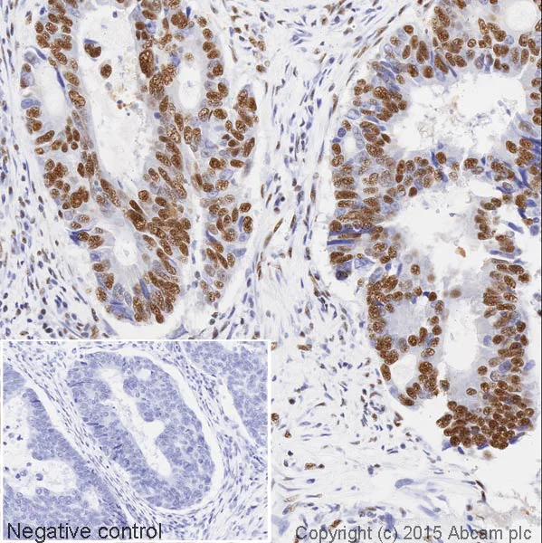 Immunohistochemistry (Formalin/PFA-fixed paraffin-embedded sections) - HRP Anti-SF3B1 antibody [EPR11986] (AB202926)