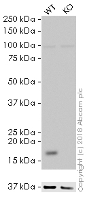 Western blot - HRP Anti-SFT antibody [EPR13000(B)] (AB215343), expandable thumbnail