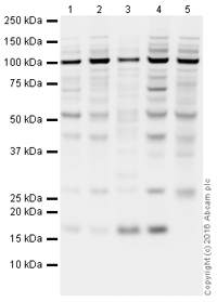 Western blot - HRP Anti-SFT antibody [EPR13000(B)] (AB215343), expandable thumbnail