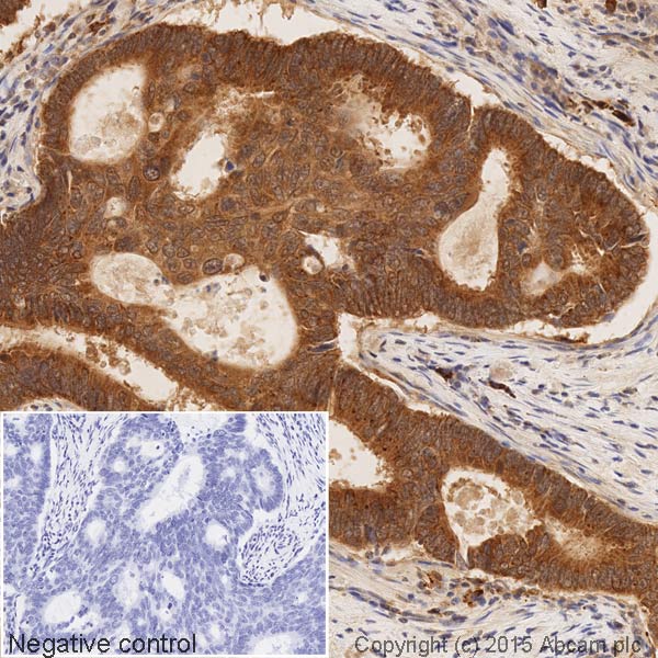 Immunohistochemistry (Formalin/PFA-fixed paraffin-embedded sections) - HRP Anti-Smad3 antibody [EP568Y] (AB204462), expandable thumbnail