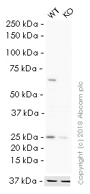 Western blot - HRP Anti-Smad4 antibody [EP618Y] (AB195554), expandable thumbnail