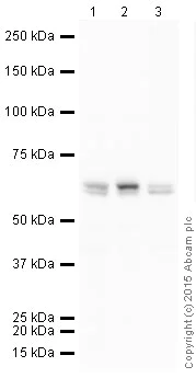 Western blot - HRP Anti-SNX27 antibody [1C6] (AB203648)