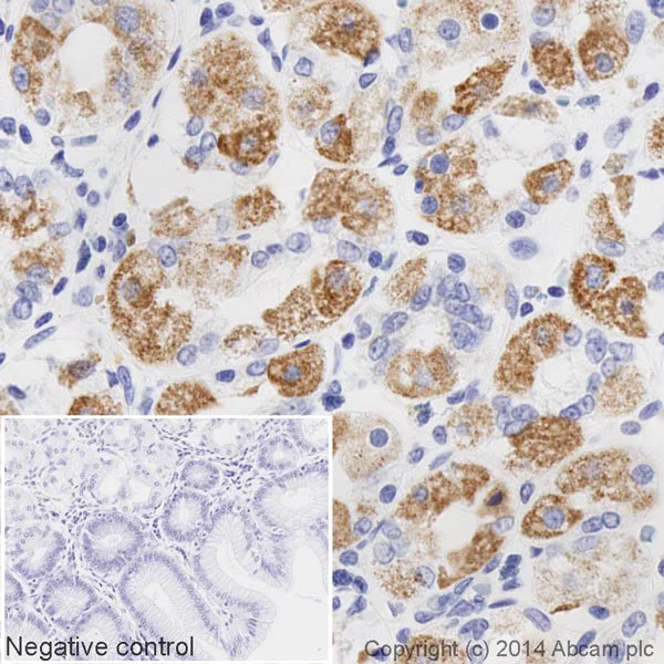 Immunohistochemistry (Formalin/PFA-fixed paraffin-embedded sections) - HRP Anti-STAT6 antibody [YE361] (AB196480)