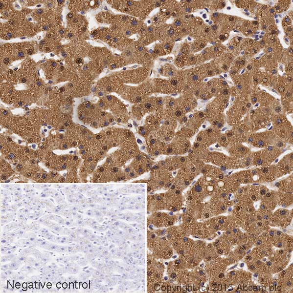 Immunohistochemistry (Formalin/PFA-fixed paraffin-embedded sections) - HRP Anti-Superoxide Dismutase 1 antibody [EP1727Y] (AB199453)