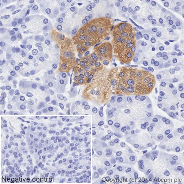 Immunohistochemistry (Formalin/PFA-fixed paraffin-embedded sections) - HRP Anti-Synaptophysin antibody [YE269] - Synaptic Marker (AB195520)