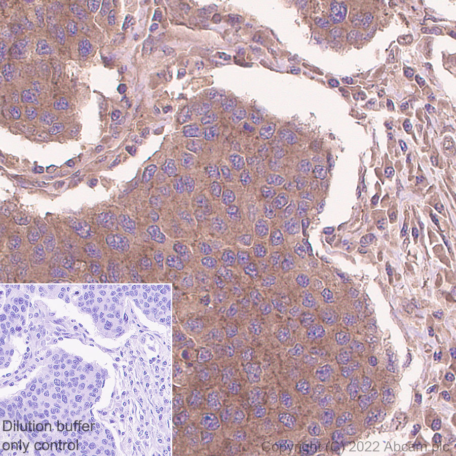 Immunohistochemistry (Formalin/PFA-fixed paraffin-embedded sections) - HRP Anti-Tissue Plasminogen Activator antibody [EPR7232(2)] (AB305217), expandable thumbnail