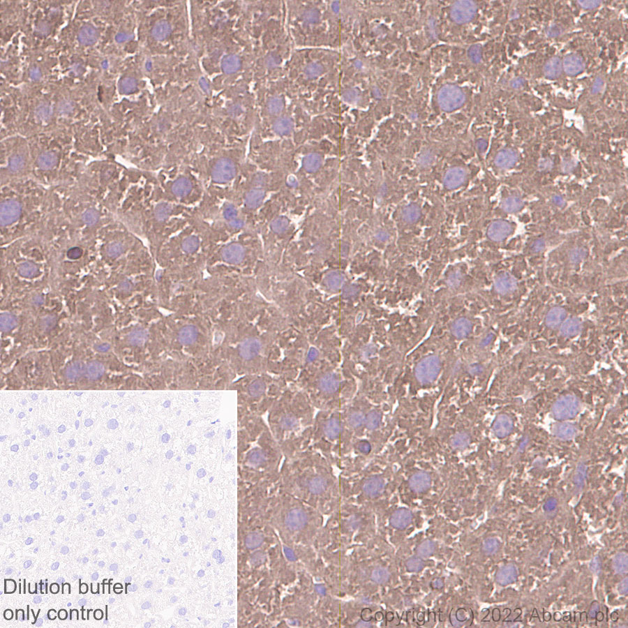 Immunohistochemistry (Formalin/PFA-fixed paraffin-embedded sections) - HRP Anti-Tissue Plasminogen Activator antibody [EPR7232(2)] (AB305217), expandable thumbnail