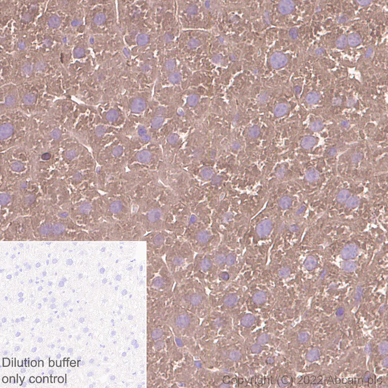 Immunohistochemistry (Formalin/PFA-fixed paraffin-embedded sections) - HRP Anti-Tissue Plasminogen Activator antibody [EPR7232(2)] (AB305217)