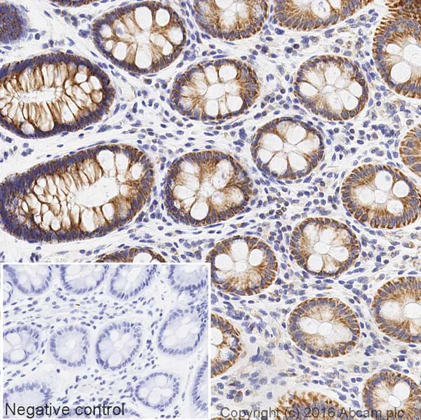 Immunohistochemistry (Formalin/PFA-fixed paraffin-embedded sections) - HRP Anti-TOMM20 antibody [EPR15581-39] - Mitochondrial Marker (AB205796)