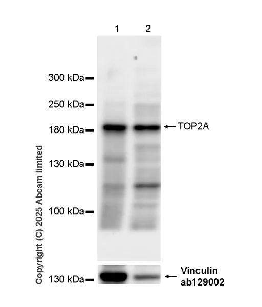 Western blot - HRP Anti-Topoisomerase II alpha antibody [EP1102Y] (AB325218)