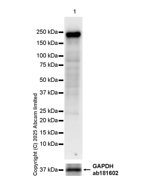 Western blot - HRP Anti-Topoisomerase II alpha antibody [EP1102Y] (AB325218)