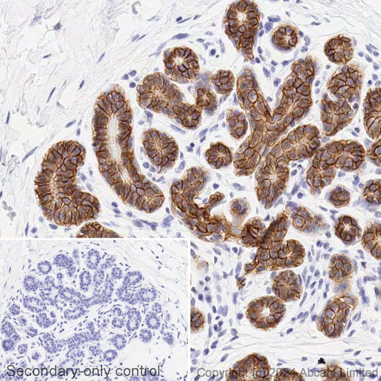 Immunohistochemistry (Formalin/PFA-fixed paraffin-embedded sections) - HRP Anti-TROP2 antibody [EPR20043] (AB303030)