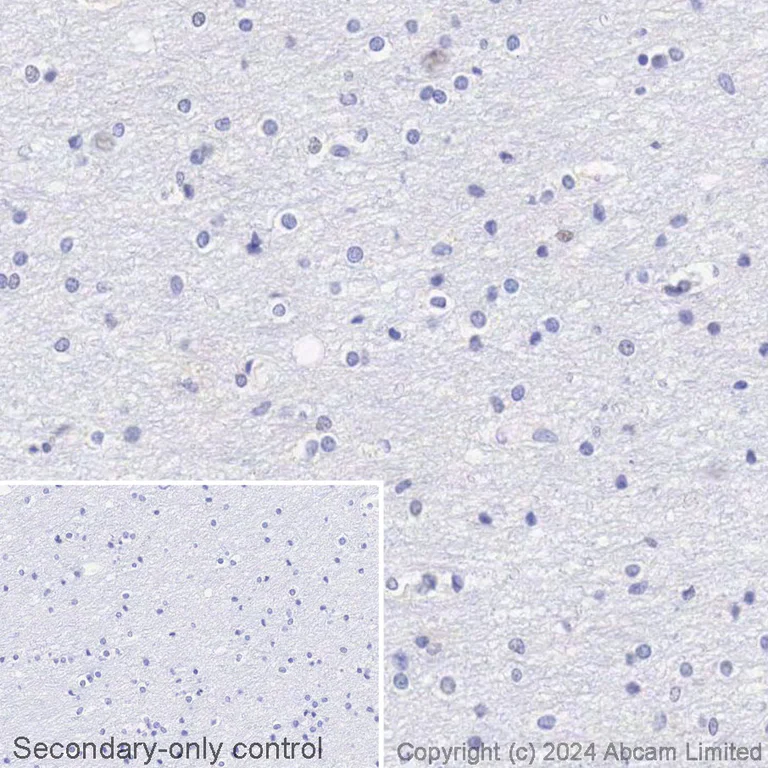 Immunohistochemistry (Formalin/PFA-fixed paraffin-embedded sections) - HRP Anti-TROP2 antibody [EPR20043] (AB303030)