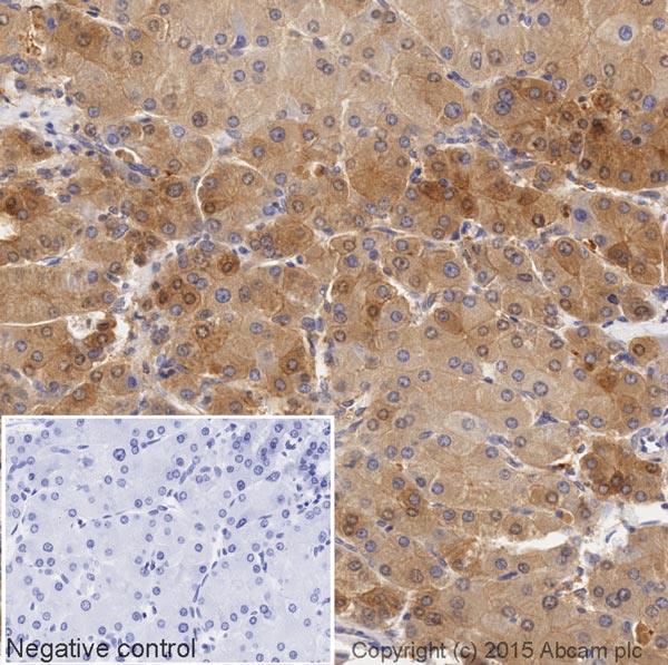 Immunohistochemistry (Formalin/PFA-fixed paraffin-embedded sections) - HRP Anti-TXNRD1 antibody [EPNCIR129] (AB203464)