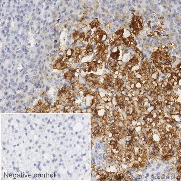 Immunohistochemistry (Formalin/PFA-fixed paraffin-embedded sections) - HRP Anti-Tyrosine Hydroxylase antibody [EP1532Y] - Neuronal Marker (AB207673)