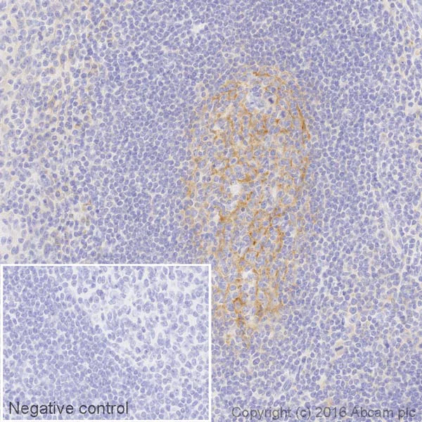 Immunohistochemistry (Formalin/PFA-fixed paraffin-embedded sections) - HRP Anti-VCAM1 antibody [EPR5047] (AB195540)