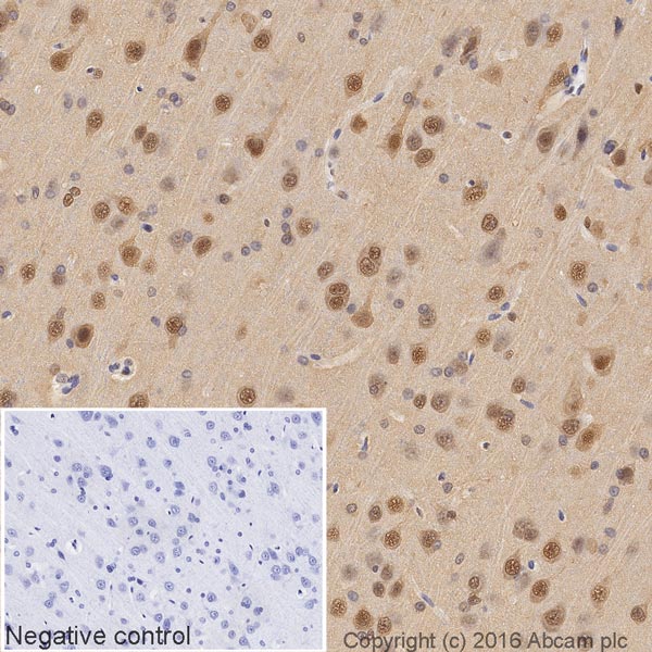 Immunohistochemistry (Formalin/PFA-fixed paraffin-embedded sections) - HRP Anti-VCP antibody [EPR3307(2)] (AB204290), expandable thumbnail