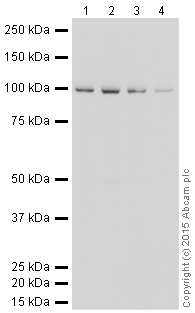 Western blot - HRP Anti-VCP antibody [EPR3307(2)] (AB204290), expandable thumbnail