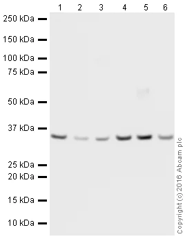 Western blot - HRP Anti-VDAC1/Porin + VDAC2 antibody [EPR10852(B)] - Mitochondrial Loading Control (AB185063)