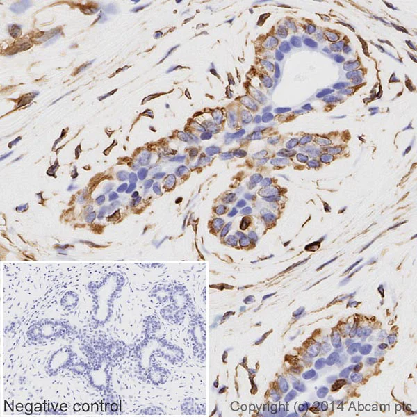 Immunohistochemistry (Formalin/PFA-fixed paraffin-embedded sections) - HRP Anti-Vimentin antibody [EPR3776] - Cytoskeleton Marker (AB194718)