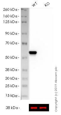 Western blot - HRP Anti-Vimentin antibody [EPR3776] - Cytoskeleton Marker (AB194718)