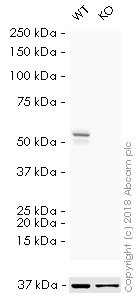 Western blot - HRP Anti-Vimentin antibody [V9] - Cytoskeleton Marker (AB196602)