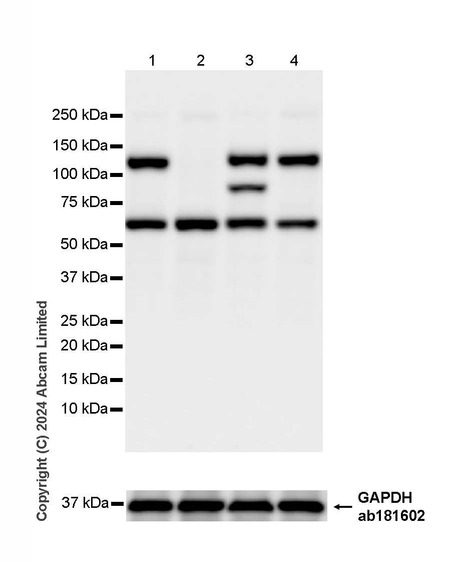 Western blot - HRP Anti-Vinculin antibody [EPR8185] - Loading Control (AB323345), expandable thumbnail