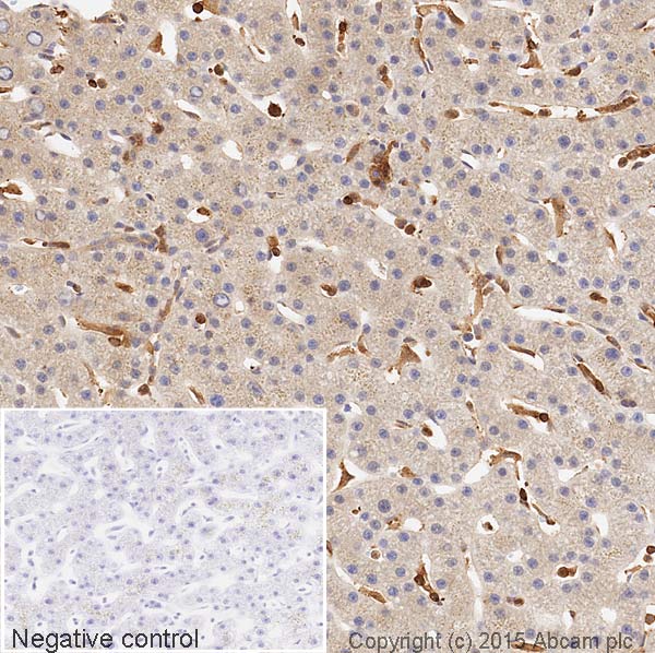 Immunohistochemistry (Formalin/PFA-fixed paraffin-embedded sections) - HRP Anti-Vitronectin/S-Protein antibody [EP873Y] (AB199310), expandable thumbnail