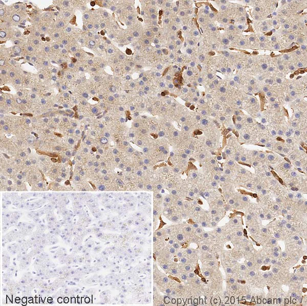 Immunohistochemistry (Formalin/PFA-fixed paraffin-embedded sections) - HRP Anti-Vitronectin/S-Protein antibody [EP873Y] (AB199310)