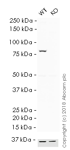 Western blot - HRP Anti-VPS35 antibody [EPR11501(B)] (AB215340), expandable thumbnail