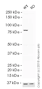 Western blot - HRP Anti-VPS35 antibody [EPR11501(B)] (AB215340)