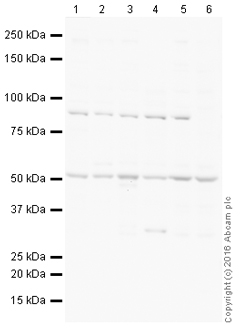 Western blot - HRP Anti-VPS35 antibody [EPR11501(B)] (AB215340), expandable thumbnail