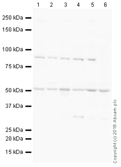 Western blot - HRP Anti-VPS35 antibody [EPR11501(B)] (AB215340)
