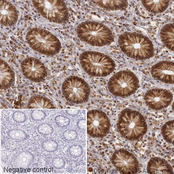 Immunohistochemistry (Formalin/PFA-fixed paraffin-embedded sections) - HRP Anti-YB1 antibody [EP2708Y] (AB204014)