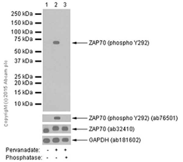 Western blot - HRP Anti-ZAP70 (phospho Y292) antibody [EPR1073] (AB199245)